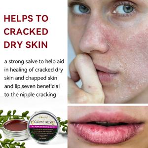 Ungüento de Comfreí Orgánico 1 oz, Extracto Herbal de Comfreí, Alivio para Picaduras de Mosquitos, Picazón, Acné, Moretones, Esguinces y Fracturas - Product Image 4