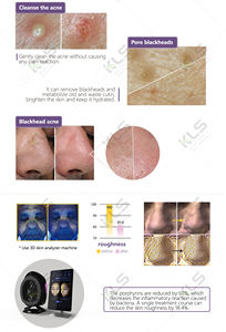 Solución de Suero Líquido, Consejos para la Máquina Facial Hydra Beauty - Product Image 3