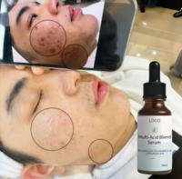 Sérum Doux Exfoliant Chimique Tri-Acide avec Complexe Multi-Acides AHA BHA PHA Solution Équilibrante Hydra pour Peaux Grasses et Acnéiques