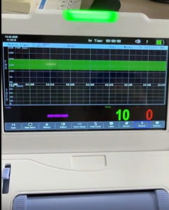 Moniteur fœtal CTG portable avec écran LCD et imprimante pour le suivi du FC et du <span class=keywords><strong>TOCO</strong></span> (compatible espagnol) - Product Image 3