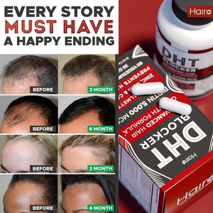 Bloqueador de DHT <span class=keywords><strong>para</strong></span> <span class=keywords><strong>la</strong></span> Caída <span class=keywords><strong>del</strong></span> <span class=keywords><strong>Cabello</strong></span>, Biotina, Saw Palmetto, Extractos de Plantas <span class=keywords><strong>para</strong></span> <span class=keywords><strong>el</strong></span> Apoyo Inmunológico, 60 Cápsulas por Botella, Uso en Adultos - Product Image 4