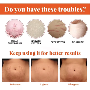 G căng Mark sửa chữa Kit bác sĩ công thức căng Mark kem mang thai chăm sóc da Kit cho vết sẹo quà tặng cho mẹ - Product Image 4