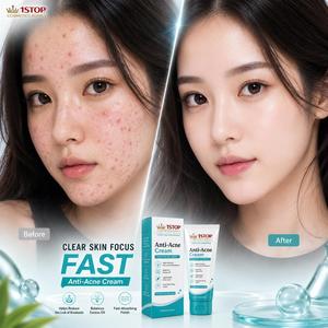 Crème éclaircissante au niacinamide pour le visage, anti-taches, hydratante, pour l'entraînement au processus de remplissage cosmétique en vrac - Product Image 1