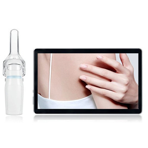 Colposcope numérique portable mini USB, caméra d'inspection vaginale pour l'auto-examen féminin - Product Image 4