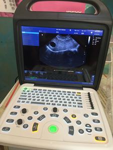 PT-10V harga rendah mesin Ultrasound dokter hewan Convex Array Probe dubur untuk peralatan Kedokteran Hewan - Product Image 5