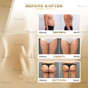 Máy kích thích cơ EMS công suất lớn 6000W, giảm cân không phẫu thuật, 16 Tesla, 5 tay cầm, thiết bị định hình cơ thể EMS để bán - Product Image 5