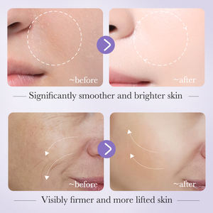 OEM BIOAQUA Niacinamide Set Essence asam hialuronat untuk melembabkan, ampul Essence Serum <span class=keywords><strong>Vitamin</strong></span> C - Product Image 6