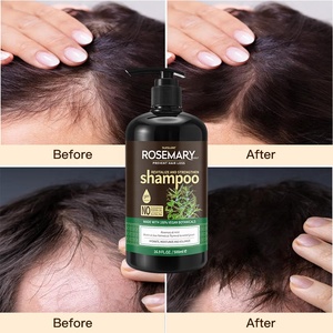 Shampooing et après-shampoing antipelliculaire à l'huile d'arbre à thé biologique pour adultes unisexe, soins capillaires chute de cheveux de 3 ans - Product Image 5