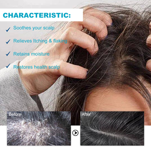 Champú para la Psoriasis Hoegoa, Limpieza Profunda, Refrescante, Anticaspa, Antipicazón, Fortalece el Cabello, Engrosa y Suaviza - Product Image 3