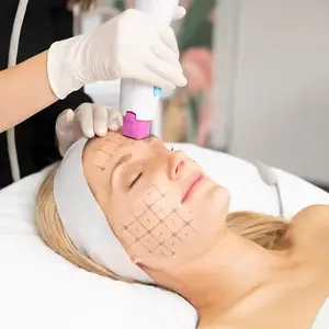 3 types de grille RF Machine de marquage de la peau du visage pour la radiofréquence Cpt Eyes Machine de levage de la peau du visage