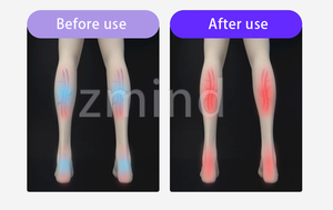 Masseurs pour les jambes pour soulager la douleur et améliorer la circulation, machine de <span class=keywords><strong>massage</strong></span> relaxante pour les pieds, les mollets et les cuisses, améliore les performances sportives - Product Image 6