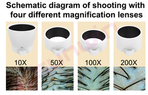 200X professionale ingrandimento microscopio per capelli dispositivo di analisi <span class=keywords><strong>della</strong></span> cura migliore perdita di capelli di rilevamento tricologia diagnostica per <span class=keywords><strong>la</strong></span> <span class=keywords><strong>clinica</strong></span> - Product Image 5