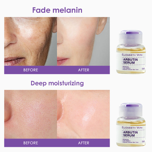 Suero de Arbutina de Grado Profesional para Salón de Belleza, Etiqueta Privada al por Mayor - Blanqueador, Iluminador, Hidratante Nocturno para Rostro y <span class=keywords><strong>Labios</strong></span>, 10ml - Product Image 4