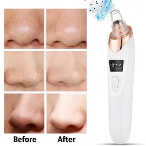 Ultrasonic Electric Facial Pore Deep Cleaning Acne Remover Vacuum Blackhead Remover