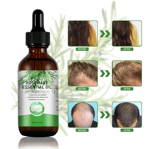 Label privé Organic100 % pure huiles essentielles naturelles de romarin et de menthe huile essentielle de feuilles de <span class=keywords><strong>Rose</strong></span> <span class=keywords><strong>Mary</strong></span> pour cheveux - Product Image 2
