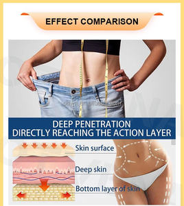 كريم تنحيف سريع المفعول من OTVENA-يحرق الدهون في 10 دقائق ، ويشرك الجلد ويقلل علامات التمدد نتائج مرئية في 7 أيام - Product Image 3