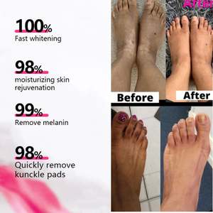 Suero de <span class=keywords><strong>Aloe</strong></span> <span class=keywords><strong>Vera</strong></span> al por Mayor, Mejora la Elasticidad de la Piel, Elimina el Acné, Suaviza las Cicatrices Faciales, Hidratante, Cosméticos Herbales - Product Image 3