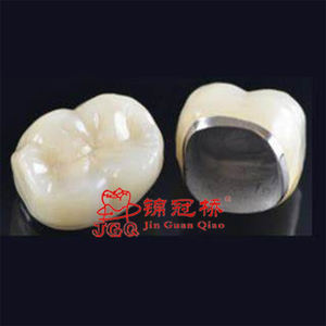 Laboratoire <span class=keywords><strong>Dentaire</strong></span> Oral Numérique 3D Imprimé Métal Céramique Pfm <span class=keywords><strong>Couronne</strong></span> et Bridges Chine <span class=keywords><strong>Prix</strong></span> - Product Image 3