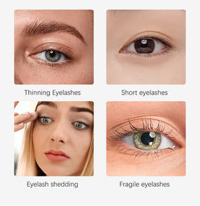 <span class=keywords><strong>El</strong></span> <span class=keywords><strong>mejor</strong></span> <span class=keywords><strong>producto</strong></span> <span class=keywords><strong>para</strong></span> <span class=keywords><strong>el</strong></span> crecimiento de <span class=keywords><strong>pestañas</strong></span>, suero <span class=keywords><strong>para</strong></span> <span class=keywords><strong>pestañas</strong></span>, mejora de <span class=keywords><strong>pestañas</strong></span>, 7 días de crecimiento, 2-3mm, resistente al agua - Product Image 5