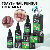 Sérum Anti-Champignons Ongles en 7 Jours Répare les Ongles et Cuticules Endommagés Traitement des Mycoses 30ml MOOYAM