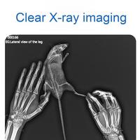 Détecteur de panneau plat à rayons X numérique léger et fin 14x17 pour l'imagerie médicale et l'utilisation vétérinaire