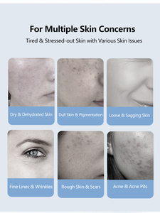 Appareil facial 6 en 1 pour un nettoyage en profondeur, une hydratation, un soin anti-âge, une revitalisation de la peau, une amélioration de la peau sèche et terne - Product Image 3