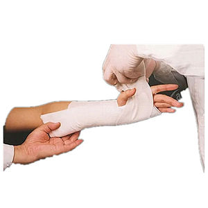 Calidad Hospital Cirugía Ortopédica Mano Pie Férula Fibra de vidrio Poliéster Férula - Product Image 6