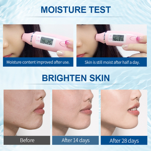 Crème hydratante anti-rides et éclaircissante pour le visage Fenyi 100ml en gros - Product Image 5