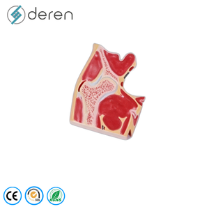 Ensemble de 4 modèles pathologiques de l'articulation du genou, modèle d'anatomie du genou en stade d'<span class=keywords><strong>arthrose</strong></span> pour l'enseignement médical - Product Image 1