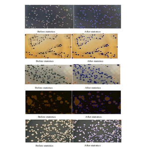 Bestselling High Definition True Color Bacterial Automated <strong>Colony</strong> <strong>Counters</strong> for Laboratory,bacterial <strong>Colony</strong> <strong>Counter</strong> LK-BCA-03+ - Product Image 4