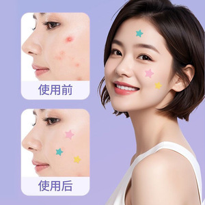 Parches para el Acné Haier Colorful Star, Hidrocoloide Médico para la Cara, para Todo Tipo de Piel, Color Rosa, Paquete de 40, Resistentes al Agua y al Sudor - Product Image 3