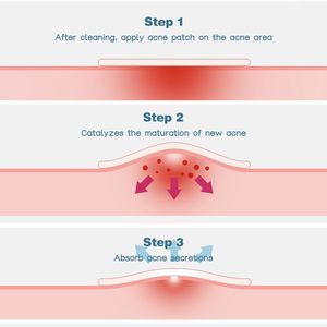 Vegan Cute Private Label Custom Logo Korean Spot Hydrocolloid Acne Pimple Patches for <b>Face</b> Pimples - Product Image 2