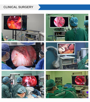 Système de caméra endoscopique IKEDA 4K pour endoscopie urologie laparoscopie ORL