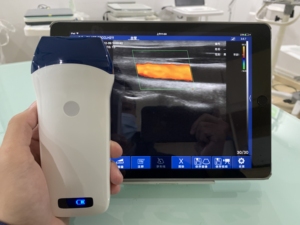 Sonde linéaire sans fil DMU37 à 128 éléments, la plus vendue, avec Doppler couleur pour MSK/Anesthésie/Vascularisation et Hôpitaux - Product Image 3
