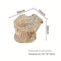 Implant dentaire détachable et modèle de résine de dent pathologique soins bucco-dentaires et démonstration de couronne de pont en PVC pour la science médicale
