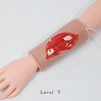 Modèles de fractures orthopédiques en silicone portables pour l'enseignement médical DARHMMY (Différents niveaux de gravité)