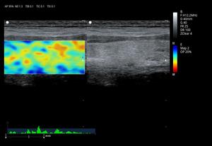 Zoncare ViV20, Sistema de Ultrasonido Doppler Color Digital Completo de Calidad Perfecta y Sistema de Diagnóstico 4D para Hospitales y Clínicas - Product Image 6