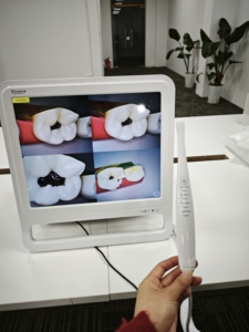 Caméra intra-orale <span class=keywords><strong>dentaire</strong></span> HD CMOS 15 mégapixels avec 8 lumières LED et Wi-Fi sans fil pour examen buccal, caméra radio numérique - Product Image 2