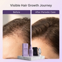 Sérum Capillaire Personnalisé à Base de Liposomes et Peptides pour l'Activation des Follicules et la Croissance des Cheveux, Redensyl GHK-Cu Biotine, Soin du Cuir Chevelu 2-EN-1, Clinique GMPC, OEM, Marque Privée