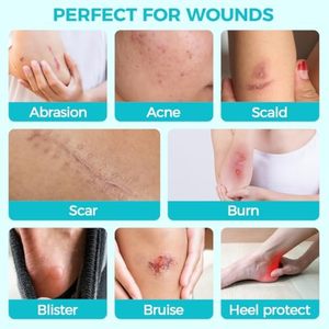 <span class=keywords><strong>Yojo</strong></span> Cắt Kích Thước Độ Dày Thêm Lớn Linh Hoạt Không Thấm Nước Siêu Thấm Nước Tự Dính Y Tế Hydrocolloid Băng Cuộn Băng EO - Product Image 4