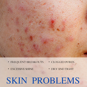 KORMESIC Gel anti-acné <span class=keywords><strong>au</strong></span> <span class=keywords><strong>soufre</strong></span> certifié Bpom, label privé, biologique, 15g, gel pour le <span class=keywords><strong>visage</strong></span>, <span class=keywords><strong>crème</strong></span> pour le <span class=keywords><strong>visage</strong></span> contre l'acné - Product Image 4