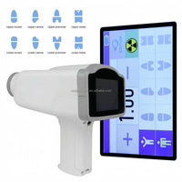 Système de dépistage aux rayons X, Appareil de radiographie portable, Scanner de bagages médical aux rayons X, Vente en gros Chine