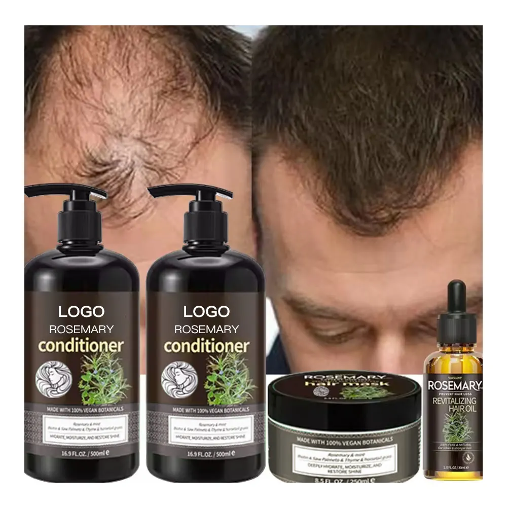 Doğal özel özel etiket Anti kayıp saç büyüme yağı ürünleri biyotin organik biberiye nane saç şampuan ve saç kremi