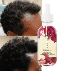 Customize Hair Products Organic Rose Hair Loss Regrowth Oil Bulk For Black Women Fast Hair Growth