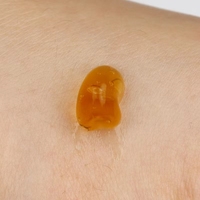 Crème pour le traitement des hémorroïdes, pommade pour les hémorroïdes, soulage la douleur, gel pour les hémorroïdes