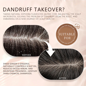 <span class=keywords><strong>2025</strong></span> mới bán buôn OEM/ODM Hữu Cơ Sophora flavescens dầu gội chăm sóc tóc chống gàu làm mới dầu gội thảo dược - Product Image 5