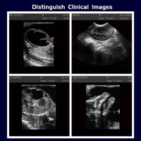 Échographe portable numérique noir et blanc pour diagnostic clinique obstétrical, gynécologique et abdominal humain
