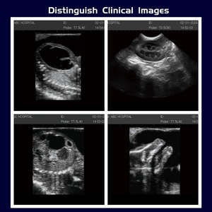 Escáner <span class=keywords><strong>de</strong></span> <span class=keywords><strong>Ultrasonido</strong></span> Portátil, Completamente Digital, en Blanco y Negro, para Diagnóstico Clínico <span class=keywords><strong>Abdominal</strong></span>, Obstetricia y Ginecología Humana - Product Image 5