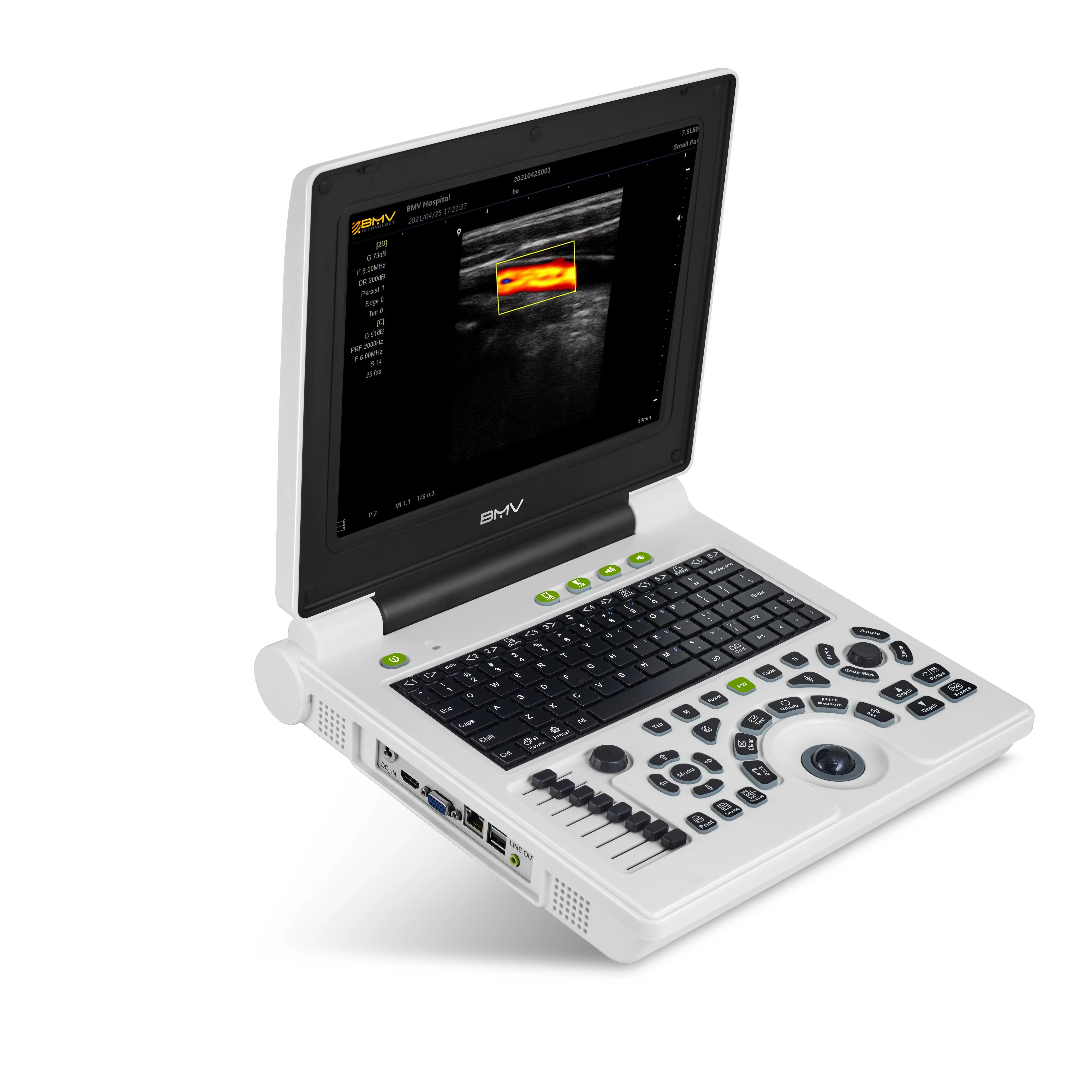 Hospital Color Doppler ultrasound M mode CW for critical care and emergency medicine on human