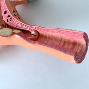 Modelo de Útero Femenino de Alta Calidad, Modelo de Útero Fantómico - Product Image 5